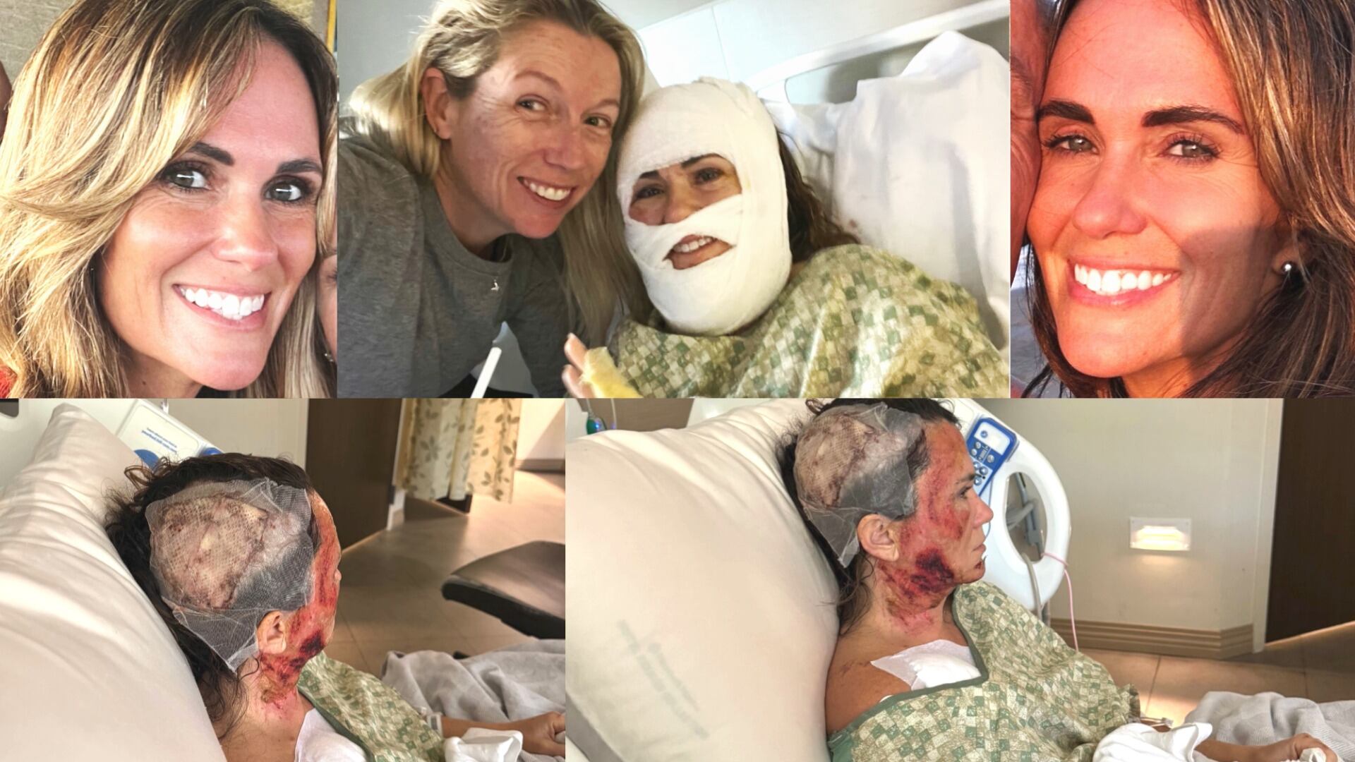 Savannah police withhold video evidence in Forsyth Park acid attack investigation