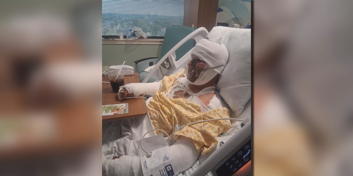 Family Exploding Family devastated after 5 badly burned in explosion that destroyed ...
